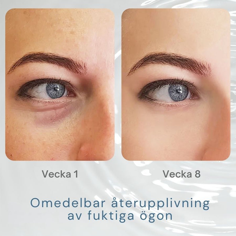 ReviveEyes™ - Peptid Förnyelsegel | 1+1 Gratis